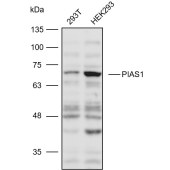 Solarbio K111059P Anti-PIAS1 Polyclonal Antibody
