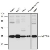 Solarbio K111464P Anti-METTL6 Polyclonal Antibody