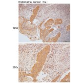 Solarbio K111787P Anti-PGAP6 Polyclonal Antibody