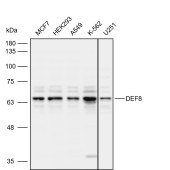 Solarbio K111986P Anti-DEF8 Polyclonal Antibody