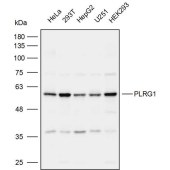 Solarbio K111958P Anti-PLRG1 Polyclonal Antibody