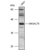 Solarbio K111270P Anti-B4GALT5 Polyclonal Antibody