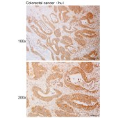 Solarbio K111107P Anti-ATXN7L1 Polyclonal Antibody