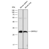 Solarbio K111756P Anti-GRPEL2 Polyclonal Antibody