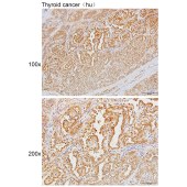 Solarbio K111644P Anti-DDX39A/B Polyclonal Antibody
