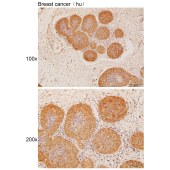 Solarbio K111937P Anti-BACE1 Polyclonal Antibody