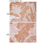 Solarbio K112114P Anti-SLC25A37 Polyclonal Antibody