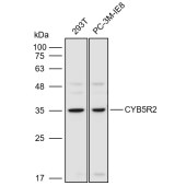Solarbio K110939P Anti-CYB5R2 Polyclonal Antibody