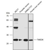 Solarbio K111465P Anti-TMED6 Polyclonal Antibody