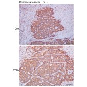 Solarbio K111672P Anti-CRYGS Polyclonal Antibody