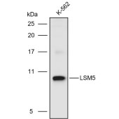 Solarbio K110954P Anti-LSM5 Polyclonal Antibody