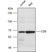 Solarbio K111281P Anti-CD6 Polyclonal Antibody