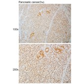 Solarbio K111127P Anti-ELAC2 Polyclonal Antibody