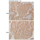 Solarbio K111232P Anti-PSPH Polyclonal Antibody