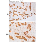 Solarbio K111775P Anti-MRPS15 Polyclonal Antibody