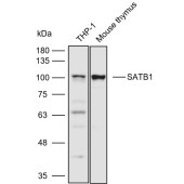 Solarbio K110561P Anti-SATB1 Polyclonal Antibody