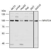 Solarbio K111297P Anti-NFATC4 Polyclonal Antibody