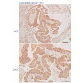 Solarbio K110603P Anti-BLOC1S2 Polyclonal Antibody