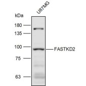 Solarbio K110990P Anti-FASTKD2 Polyclonal Antibody