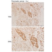 Solarbio K111987P Anti-DEF8 Polyclonal Antibody