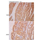 Solarbio K111938P Anti-AKR1C4 Polyclonal Antibody