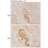 Solarbio K111903P Anti-ROM1 Polyclonal Antibody