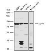 Solarbio K110837P Anti-DLG4 Polyclonal Antibody