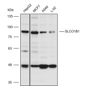 Solarbio K110821P Anti-SLCO1B1 Polyclonal Antibody