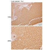 Solarbio K111718P Anti-MPPED1 Polyclonal Antibody