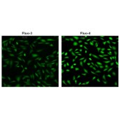 Solarbio CA1190 Fluo-4,AM钙离子浓度检测试剂盒