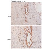 Solarbio K111017P Anti-SNAPC5 Polyclonal Antibody