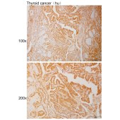 Solarbio K111038P Anti-SMARCAL1 Polyclonal Antibody