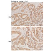 Solarbio K111607P Anti-DHDDS Polyclonal Antibody