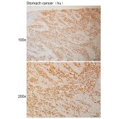 Solarbio K110962P Anti-POGZ Polyclonal Antibody
