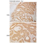 Solarbio K111119P Anti-TACC3 Polyclonal Antibody