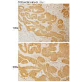 Solarbio K110909P Anti-MTCL1 Polyclonal Antibody
