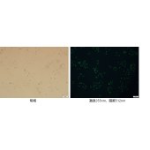 Solarbio G0170 细胞自噬染色检测试剂盒(MDC法)