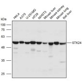 Solarbio K111278P Anti-STK24 Polyclonal Antibody