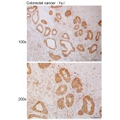 Solarbio K111109P Anti-PDE10A Polyclonal Antibody