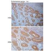 Solarbio K111121P Anti-CDH3 Polyclonal Antibody