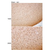 Solarbio K111888P Anti-CNTN4 Polyclonal Antibody