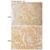 Solarbio K111036P Anti-EMD Polyclonal Antibody