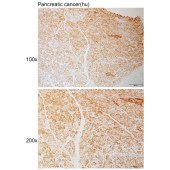 Solarbio K111088P Anti-IKBKB Polyclonal Antibody