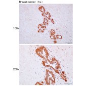 Solarbio K111597P Anti-RANBP17 Polyclonal Antibody