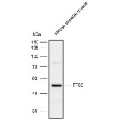 Solarbio K111876P Anti-TP63 Polyclonal Antibody