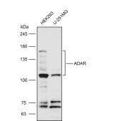 Solarbio K111634P Anti-ADAR Polyclonal Antibody