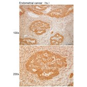 Solarbio K111306P Anti-AKAP1 Polyclonal Antibody