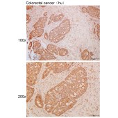 Solarbio K111719P Anti-TWF1 Polyclonal Antibody