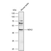 Solarbio K112104P Anti-NEK2 Polyclonal Antibody