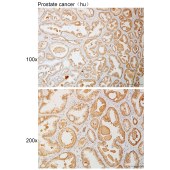 Solarbio K111095P Anti-ATXN1 Polyclonal Antibody